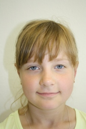Monika skoro 2 měsíce po operaci